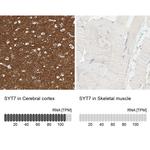 Synaptotagmin 7 Antibody in Immunohistochemistry (IHC)