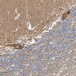 Synaptotagmin 7 Antibody in Immunohistochemistry (IHC)