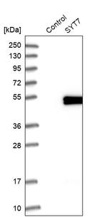 Synaptotagmin 7 Antibody in Western Blot (WB)