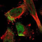 C17orf80 Antibody in Immunocytochemistry (ICC/IF)