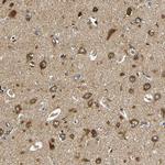 VAPB Antibody in Immunohistochemistry (IHC)