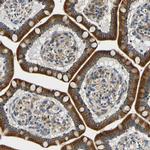 VAPB Antibody in Immunohistochemistry (IHC)