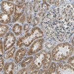 VAPB Antibody in Immunohistochemistry (IHC)