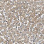 VAPB Antibody in Immunohistochemistry (IHC)