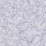 SLC6A1 Antibody in Immunohistochemistry (IHC)