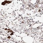 PTPN22 Antibody in Immunohistochemistry (IHC)