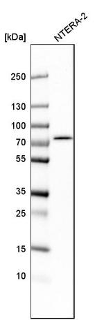 TBC1D15 Antibody in Western Blot (WB)