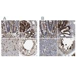 HIP1 Antibody in Immunohistochemistry (IHC)