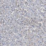 HIP1 Antibody in Immunohistochemistry (IHC)