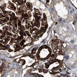 HIP1 Antibody in Immunohistochemistry (IHC)