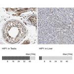 HIP1 Antibody