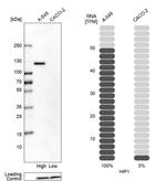 HIP1 Antibody in Western Blot (WB)