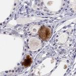 C16orf89 Antibody in Immunohistochemistry (IHC)