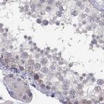 C16orf89 Antibody in Immunohistochemistry (IHC)