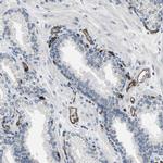 SLCO2A1 Antibody in Immunohistochemistry (IHC)