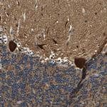 KIAA1551 Antibody in Immunohistochemistry (IHC)