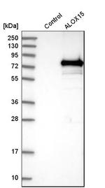 ALOX15 Antibody in Western Blot (WB)