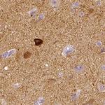 NECAB2 Antibody in Immunohistochemistry (IHC)