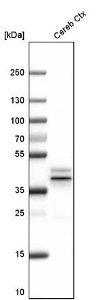 NECAB2 Antibody in Western Blot (WB)