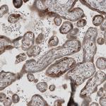 KANK4 Antibody in Immunohistochemistry (IHC)