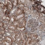 KANK4 Antibody in Immunohistochemistry (IHC)