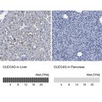 CLEC4G Antibody in Immunohistochemistry (IHC)