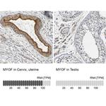 MYOF Antibody