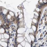 Axotrophin Antibody in Immunohistochemistry (IHC)