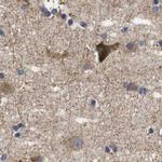 Axotrophin Antibody in Immunohistochemistry (IHC)