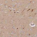 COX6C Antibody in Immunohistochemistry (IHC)