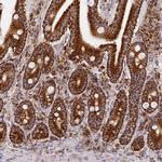 COX6C Antibody in Immunohistochemistry (IHC)