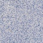 PRRT2 Antibody in Immunohistochemistry (IHC)