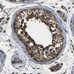 DHPS Antibody in Immunohistochemistry (IHC)