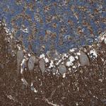 GSG1L Antibody in Immunohistochemistry (IHC)