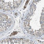 CLCN2 Antibody in Immunohistochemistry (IHC)