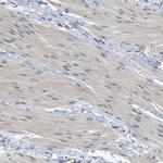 TNFAIP1 Antibody in Immunohistochemistry (IHC)