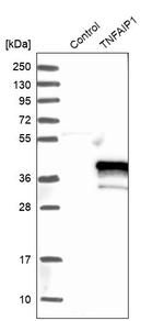 TNFAIP1 Antibody in Western Blot (WB)