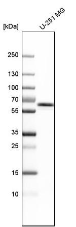 UAP1 Antibody in Western Blot (WB)