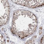 SLC25A22 Antibody in Immunohistochemistry (IHC)