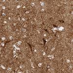 SLC25A22 Antibody in Immunohistochemistry (IHC)