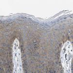 EMP2 Antibody in Immunohistochemistry (IHC)