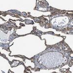 EMP2 Antibody in Immunohistochemistry (IHC)