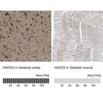 PTPLAD1 Antibody in Immunohistochemistry (IHC)