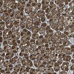 TSG Antibody in Immunohistochemistry (IHC)