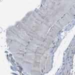 DENND4C Antibody in Immunohistochemistry (IHC)