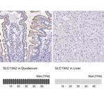 SLC13A2 Antibody