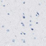 NKCC2 Antibody in Immunohistochemistry (IHC)