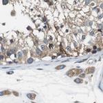 UGGT1 Antibody in Immunohistochemistry (IHC)