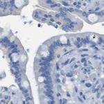 B4GALNT1 Antibody in Immunohistochemistry (IHC)