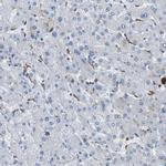 FCGRT Antibody in Immunohistochemistry (IHC)